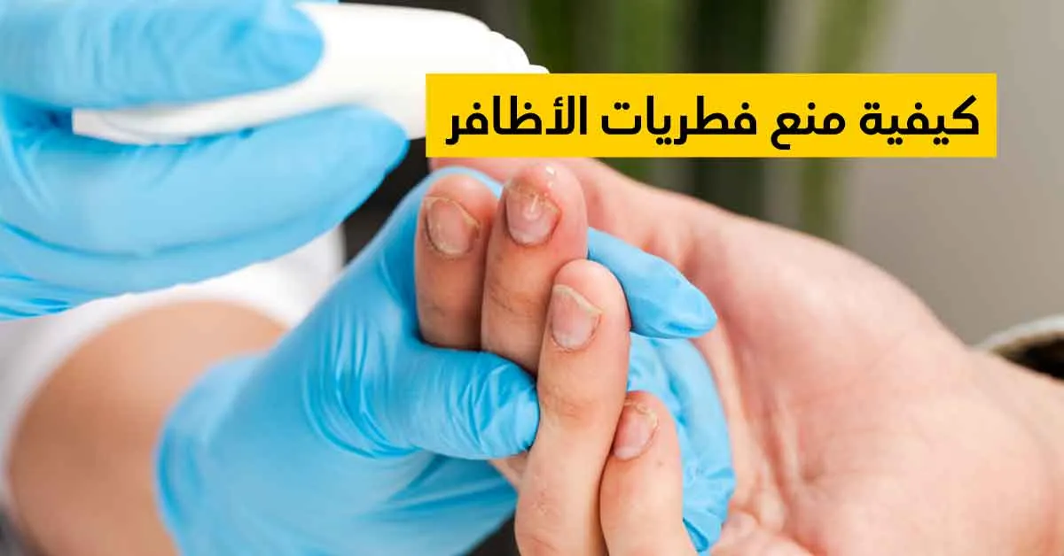 كيفية منع فطريات الأظافر